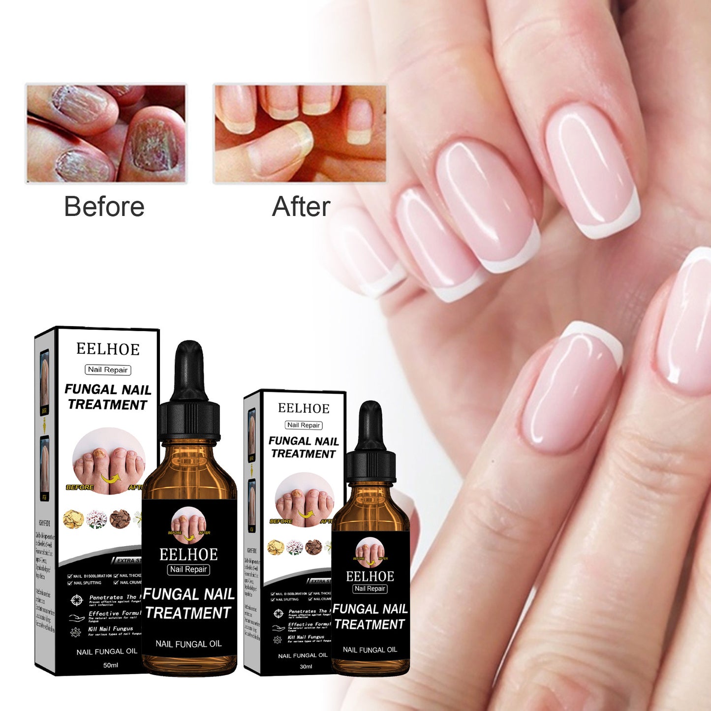 EELHOE Nail Repair Solution, Thickening And Brightening Nails Removing Gray Nail Repair Nourishing Nail Care Solution